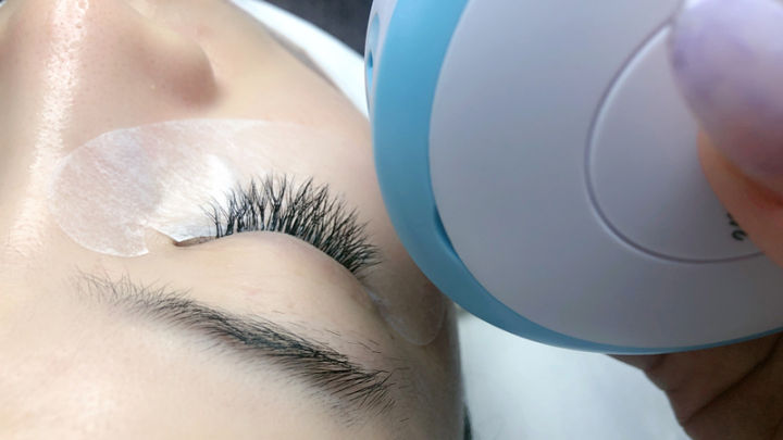 What is Eyelash Extensions Allergy
